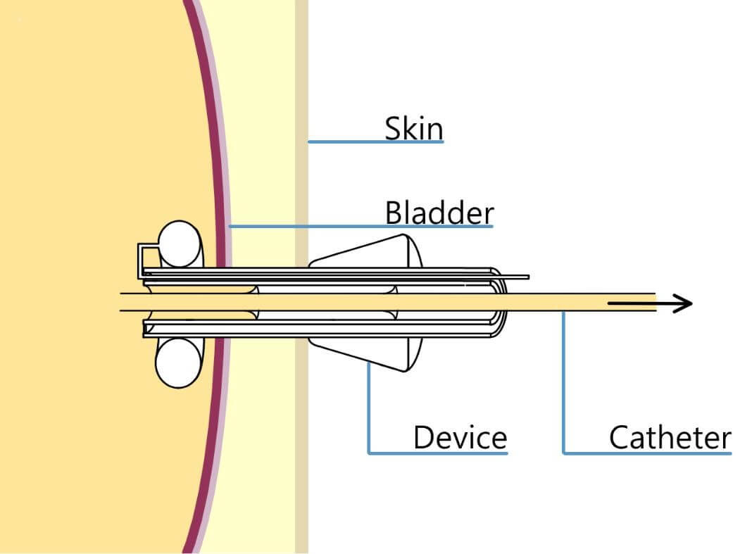 Beth Cutting figure 3
